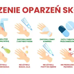 Co na oparzenia u dziecka: chłodna woda, maść z antybiotykiem, zimny kompres, aloes. Nie używaj masła, jajka, pasty do zębów, lodu.