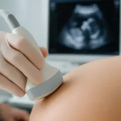 Pierwsze usg w ciąży. Dłoń w rękawiczce przykłada sondę do brzucha, na ekranie widać obraz płodu.