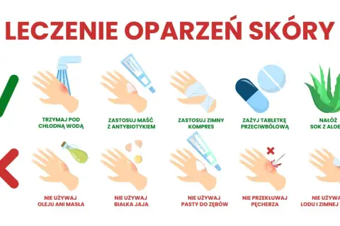 Co na oparzenia u dziecka: chłodna woda, maść z antybiotykiem, zimny kompres, aloes. Nie używaj masła, jajka, pasty do zębów, lodu.