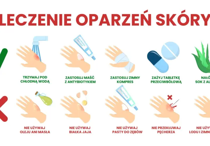 Co na oparzenia u dziecka: chłodna woda, maść z antybiotykiem, zimny kompres, aloes. Nie używaj masła, jajka, pasty do zębów, lodu.
