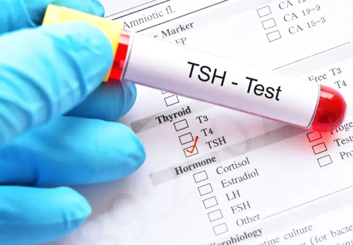 Ręka w niebieskiej rękawiczce trzyma probówkę z napisem "TSH - Test". Zaznaczono TSH na liście badań hormonalnych, co może być związane z diagnostyką tsh w ciąży.