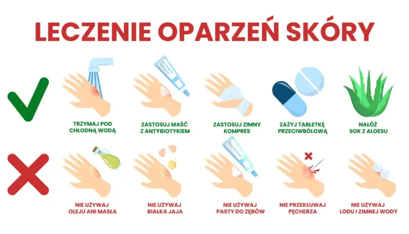 Co na oparzenia u dziecka: chłodna woda, maść z antybiotykiem, zimny kompres, aloes. Nie używaj masła, jajka, pasty do zębów, lodu.