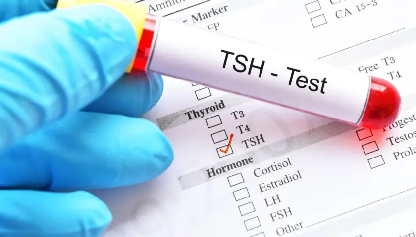 Ręka w niebieskiej rękawiczce trzyma probówkę z napisem "TSH - Test". Zaznaczono TSH na liście badań hormonalnych, co może być związane z diagnostyką tsh w ciąży.