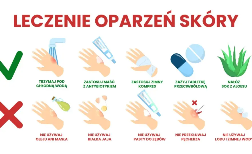 Co na oparzenia u dziecka? Pierwsza pomoc krok po kroku