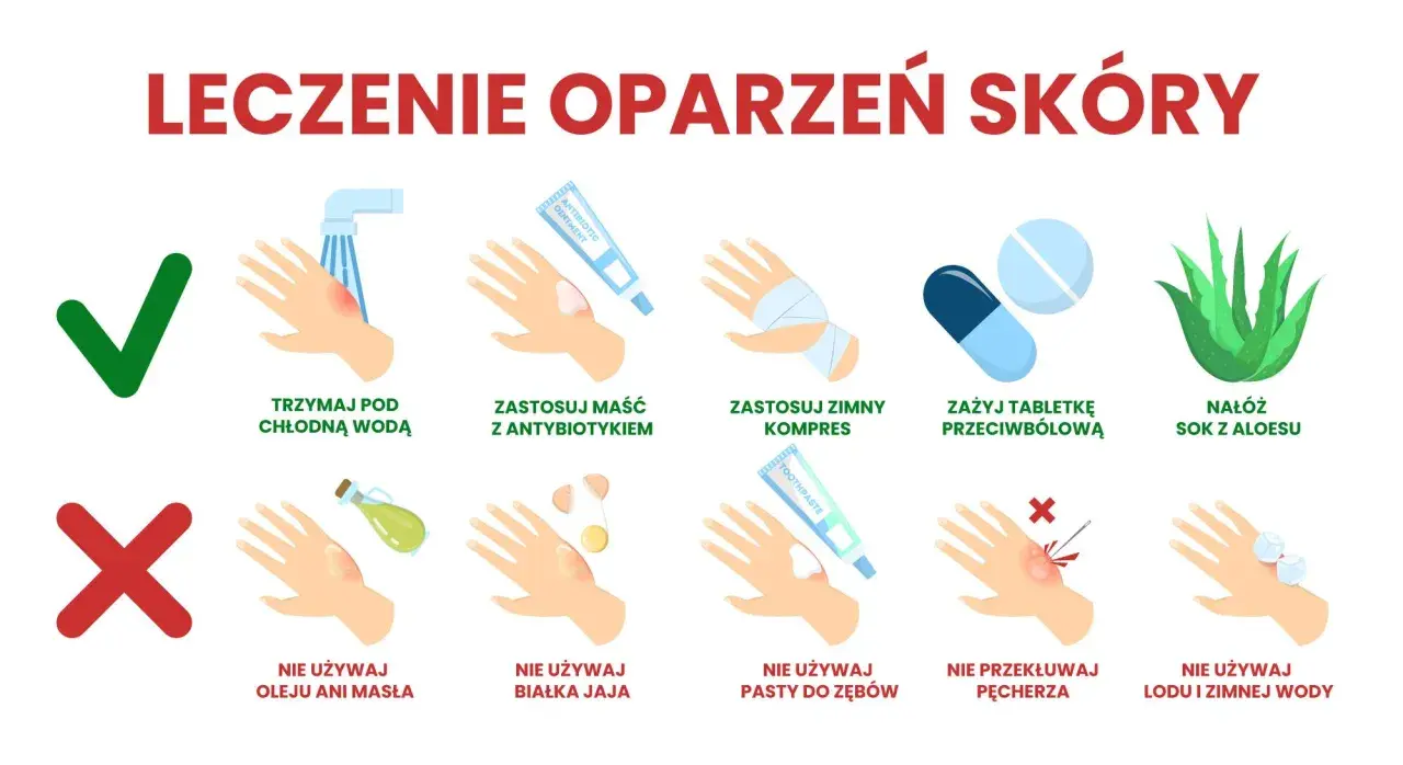 Co na oparzenia u dziecka: chłodna woda, maść z antybiotykiem, zimny kompres, aloes. Nie używaj masła, jajka, pasty do zębów, lodu.
