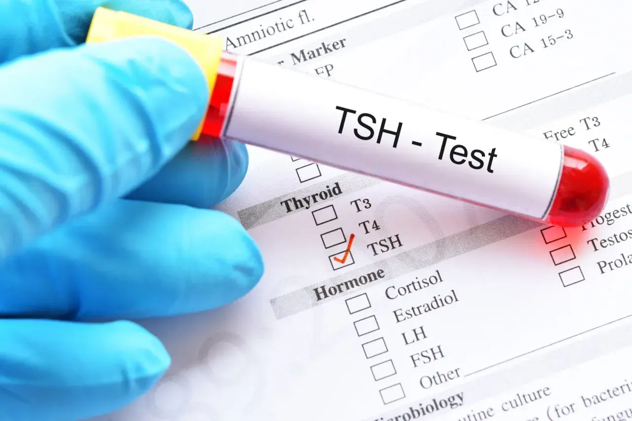 Ręka w niebieskiej rękawiczce trzyma probówkę z napisem "TSH - Test". Zaznaczono TSH na liście badań hormonalnych, co może być związane z diagnostyką tsh w ciąży.