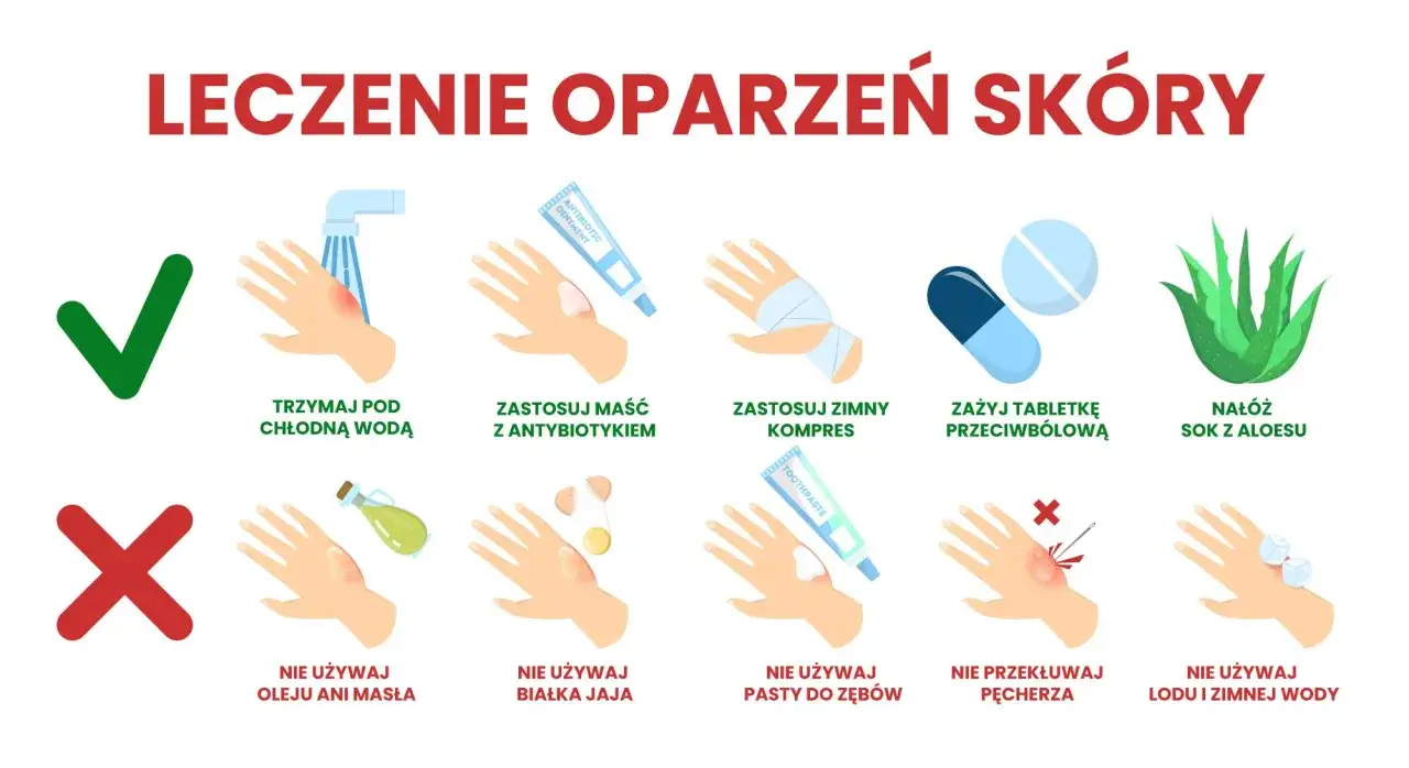 Co na oparzenia u dziecka: chłodna woda, maść z antybiotykiem, zimny kompres, aloes. Nie używaj masła, jajka, pasty do zęb&oacute;w, lodu.