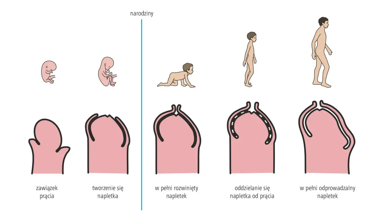 Rozw&oacute;j napletka u chłopca: od zawiązka prącia, przez tworzenie się napletka, aż do jego pełnego odprowadzenia. Kiedy odciągać napletek u chłopca? Ilustracja pokazuje naturalny proces.