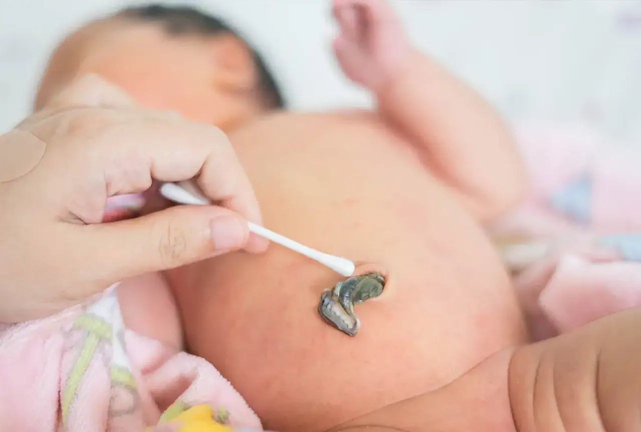 Delikatna pielęgnacja pępka noworodka. Wacik kosmetyczny dotyka pępka, kt&oacute;ry zaczyna się goić.